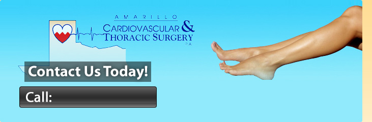 Varicose Vein Clinic of Amarillo | Spider Veins in Amarillo, TX